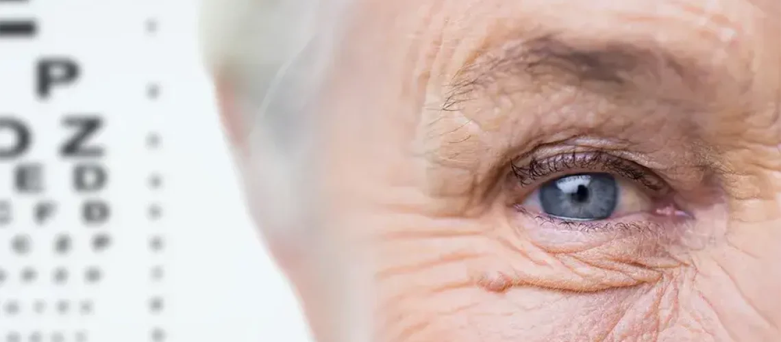 understanding cataracts